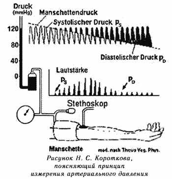 Рисунок Короткова поясняющий принцип измерения артериального давления